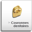 Couronnes dentaire en or